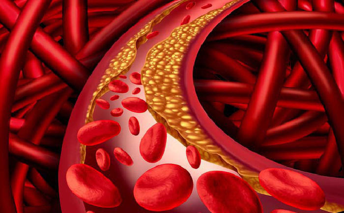 Quả óc chó giúp làm giảm cholesterol trong máu