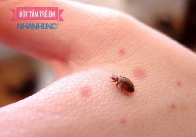 8. Trị vết thương và vết côn trùng