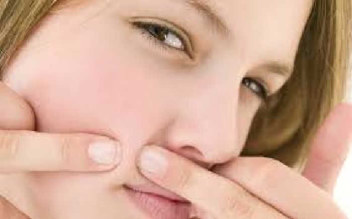 Điều trị mụn trứng cá