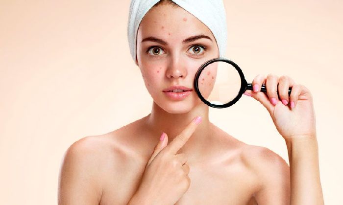 Ngưng sử dụng các loại mỹ phẩm không phù hợp