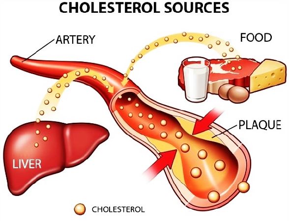 5. Đẩy lùi mỡ máu, giảm lượng cholesterol trong máu