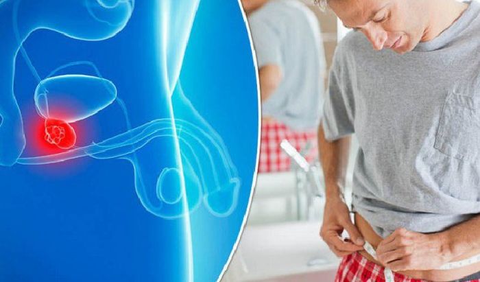 Giảm nguy cơ ung thư tuyến tiền liệt