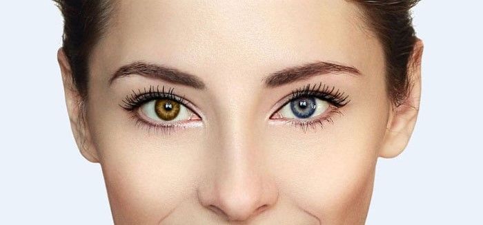 Loạn sắc tố mống mắt