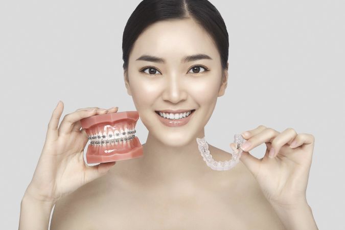 Quy trình niềng răng như thế nào?