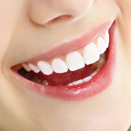 Lợi ích của việc niềng răng?