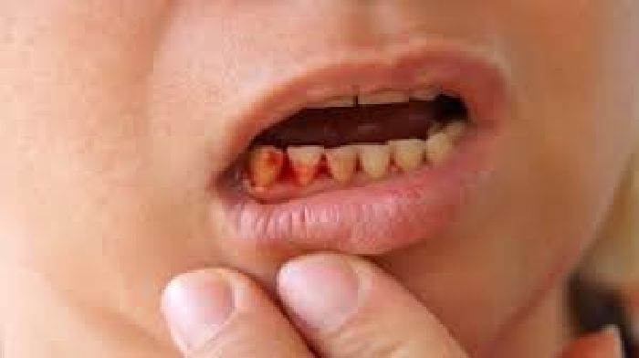 Hút thuốc lá quá nhiều