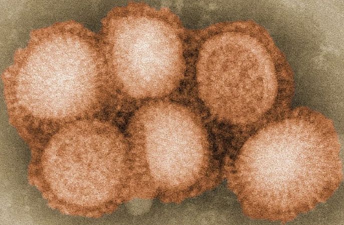 Virus cúm A(H1N1)