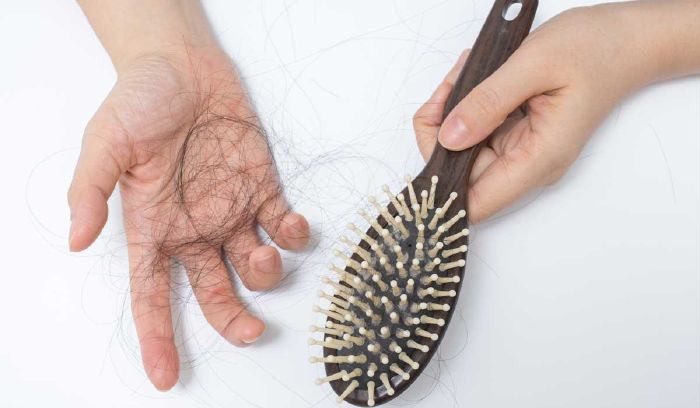 Trường hợp nghiêm trọng có thể gây rụng tóc