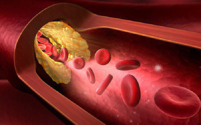 Giảm lipid máu và cholesterol trong máu