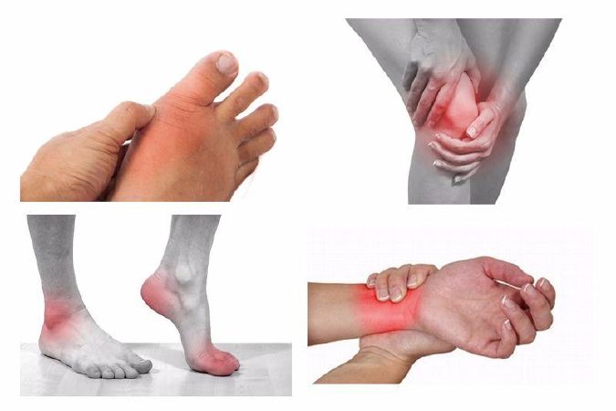 Điều trị viêm khớp