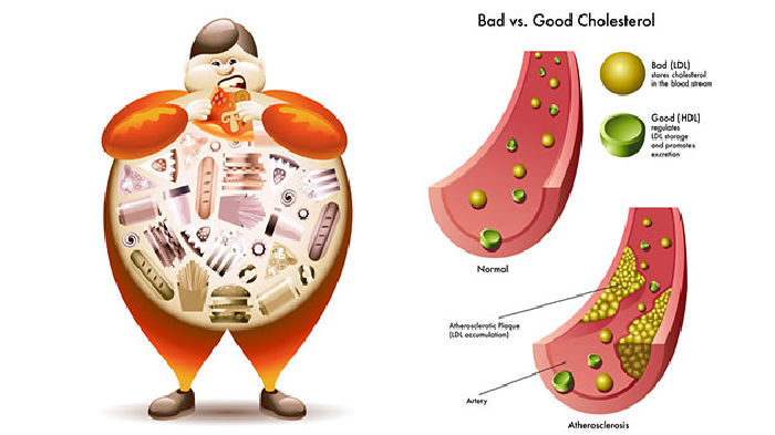 Giảm cholesterol xấu