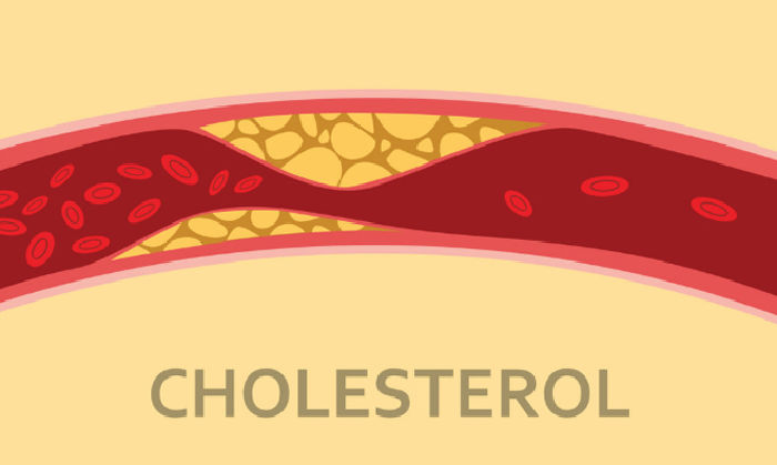 Kiểm soát mức cholesterol