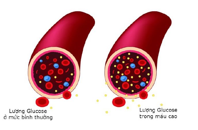 Ổn định đường trong máu