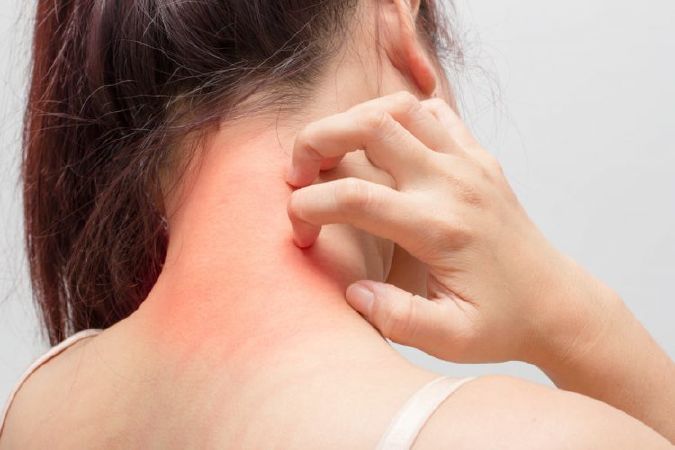 Giảm nguy cơ bị dị ứng
