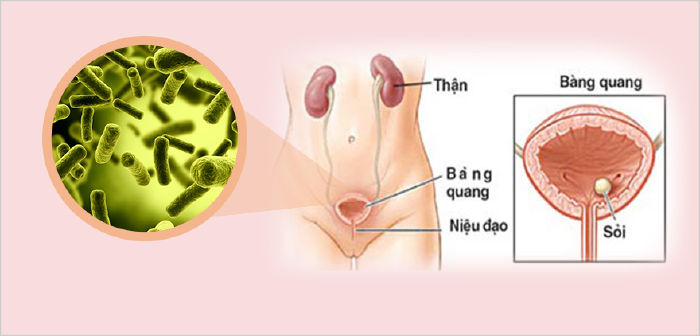 Nâng cao sức khỏe đường tiết niệu