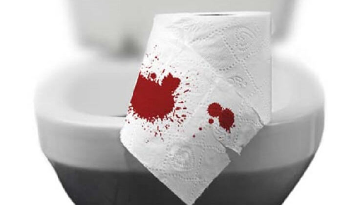 Người bị kiết lỵ, đi đại tiện có dính máu