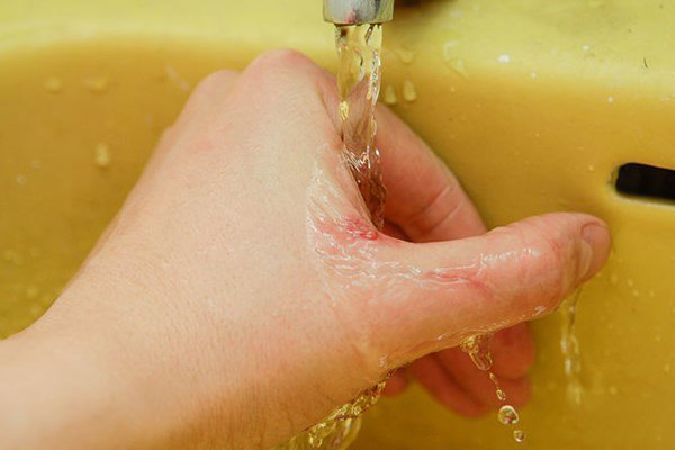 Rửa vết thương bằng nước muối