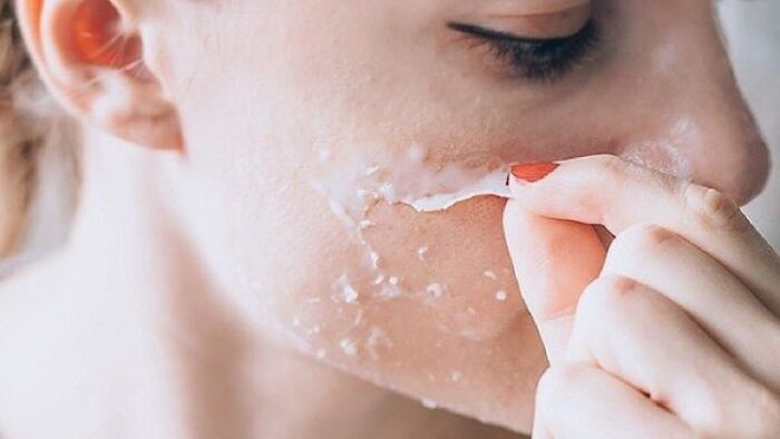 Giúp giảm tổn thương da