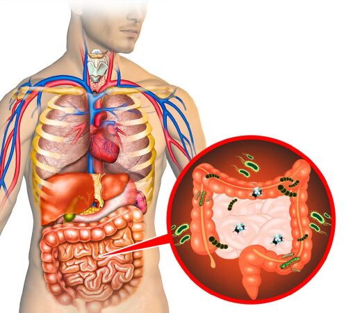 Giải độc tố