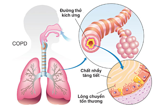 Tốt cho hệ hô hấp