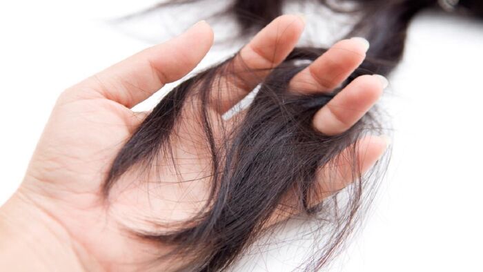 Trị rụng tóc