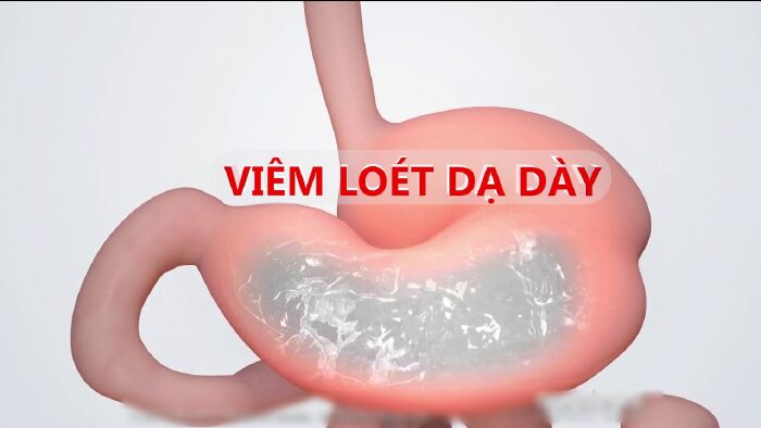 Những người bị bệnh liên quan tới đường ruột