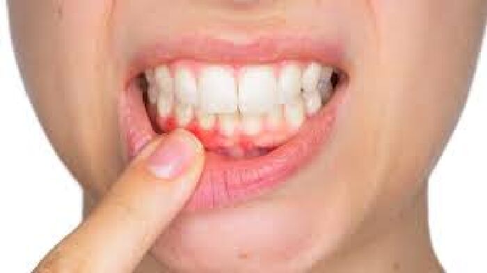 Tiêu sưng, lợi tiểu
