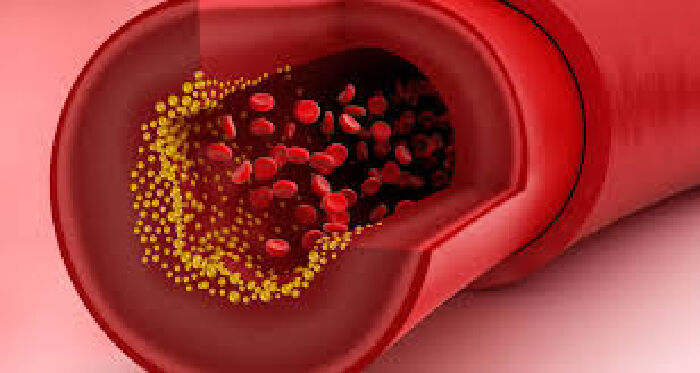 Ổn định cholesterol trong máu