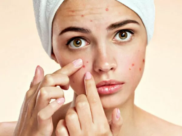 Thay đổi hormone ở tuổi dậy thì