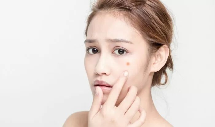 Chạm tay vào mặt quá nhiều