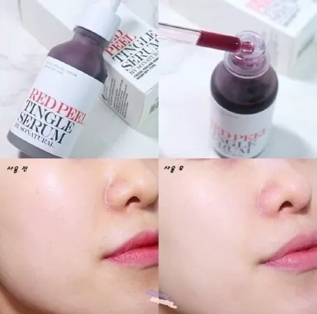 Tinh chất Red Peel Tingle Serum