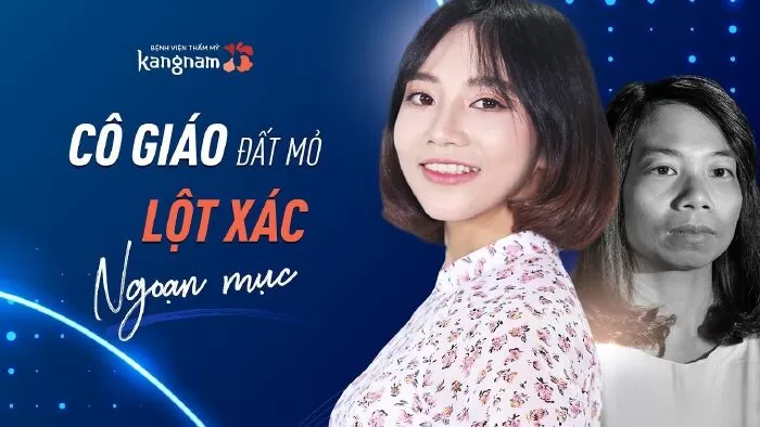 Viện thẩm mỹ dành cho nữ tại Hà Nội - Kang Nam