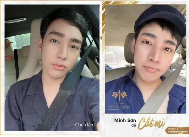 Thẩm mỹ Beauty Center – by Tấm