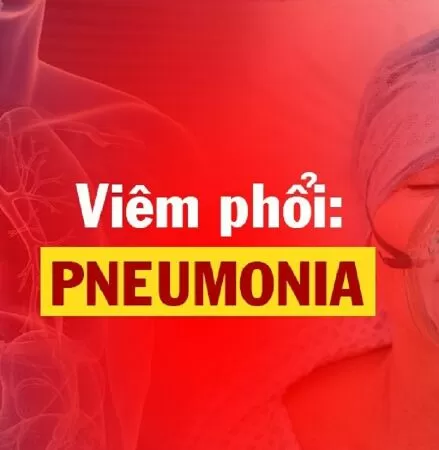 Bài giảng viêm phổi cộng đồng