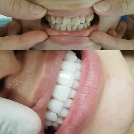 Thẩm mỹ Hàn Quốc