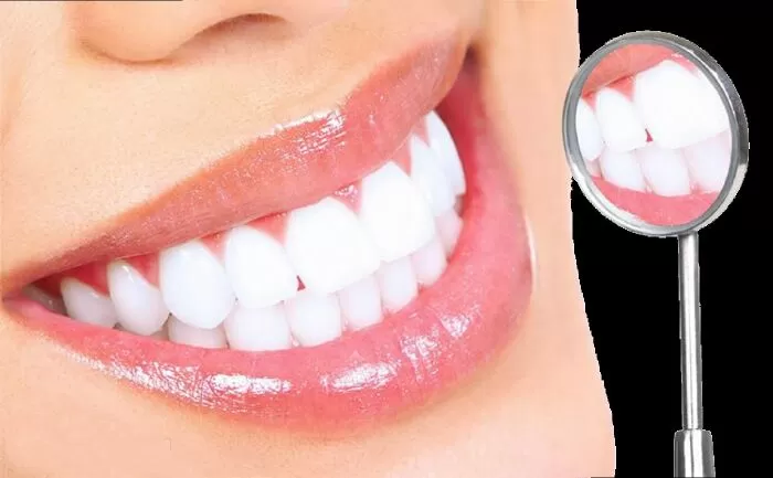 Top 10 điểm tẩy trắng răng tại Bắc Ninh chất lượng nhất