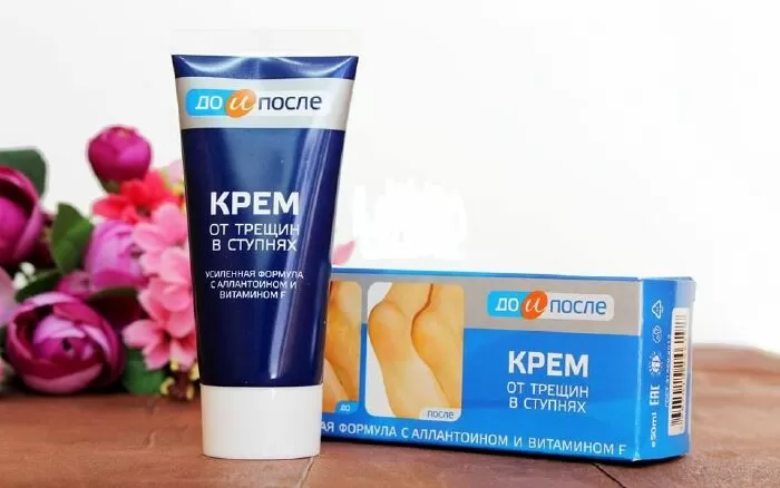 Kem trị nứt gót chân Kpem Apteka