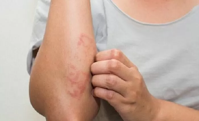 Tránh các sản phầm có thành phần dễ gây kích ứng