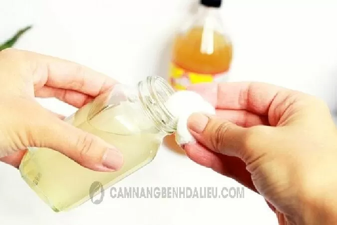 Điều trị bệnh hắc lào hiệu quả