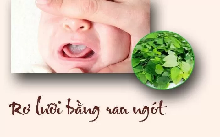 Trị tưa lưỡi ở trẻ bằng rau ngót