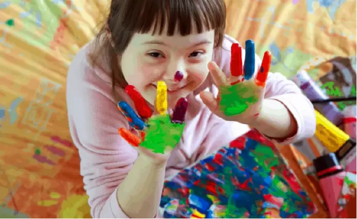 Tình trạng này đã xuất hiện trong nhiều thế kỷ, nhưng chỉ được biết đến từ thế kỷ 19