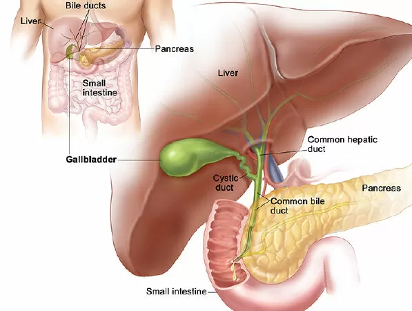 Giúp ngăn ngừa sỏi túi mật