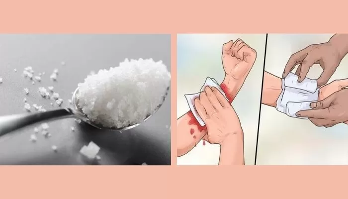 Cầm máu tự nhiên