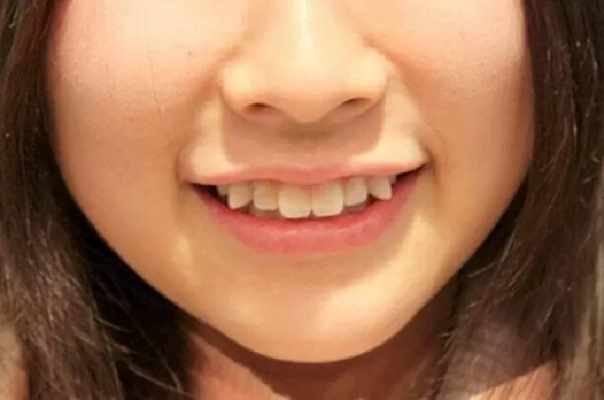 Nha khoa Tâm Đức Smile