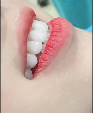 Top 10 địa chỉ nha khoa chất lượng an toàn uy tín nhất Củ Chi TP. Hồ Chí Minh