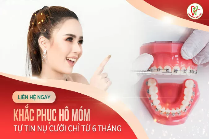 Nha Khoa Việt Đức