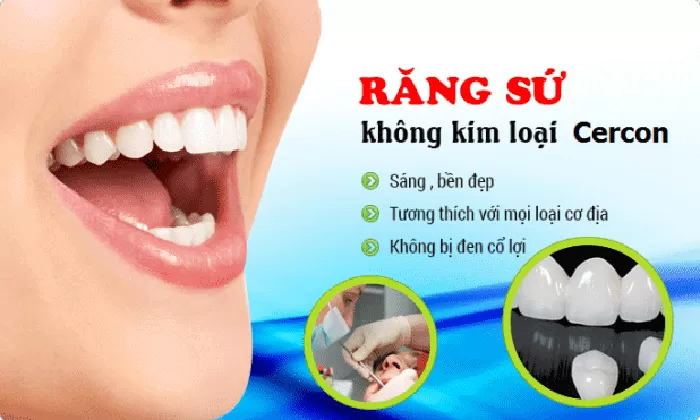 Nha khoa Pháp Việt