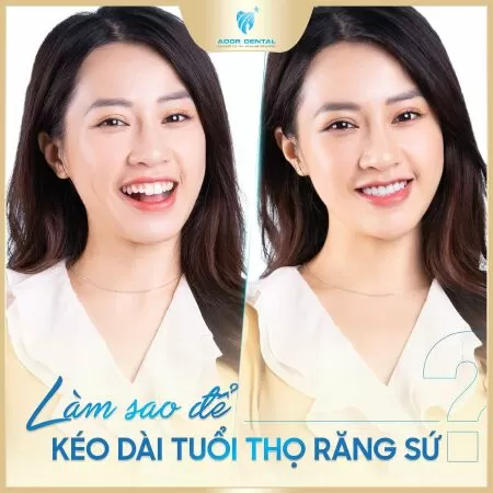 Nha Khoa Ador Dental