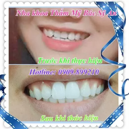 Nha khoa thẩm mỹ bác sĩ An