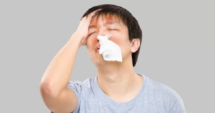 Viêm mũi